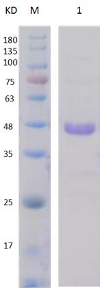 12% SDS-PAGE analysis profiles of purified PA3115-644-919 (CBB stained).